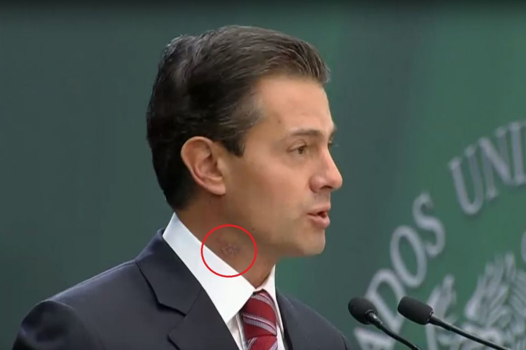 VIDEO – ¿Qué le pasó a EPN en el cuello?