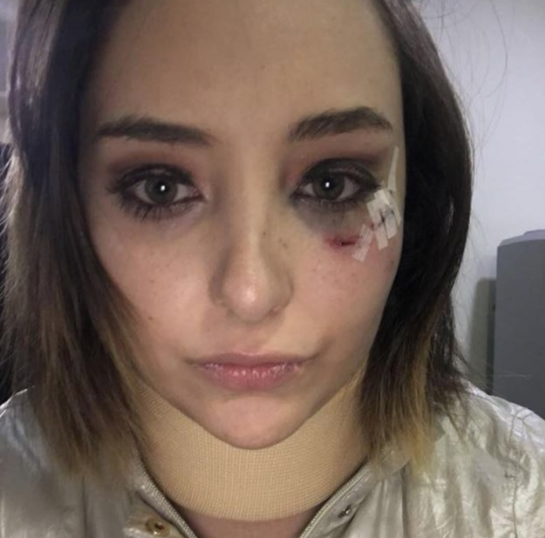 VIDEO+FOTOS: Actriz de Televisa acusa a compañero de abuso sexual y él la golpea