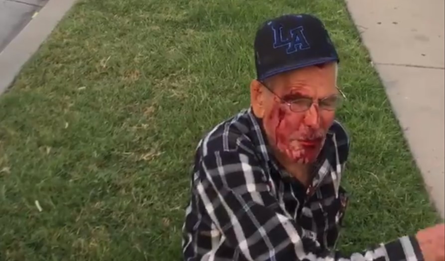 Atacan a anciano mexicano en EE.UU con un ladrillo «¡regresa a tu país!» le gritan