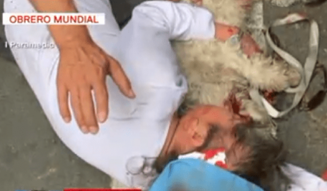 Pitbull ataca a una anciana y a su mascota en la Narvarte de la CDMX