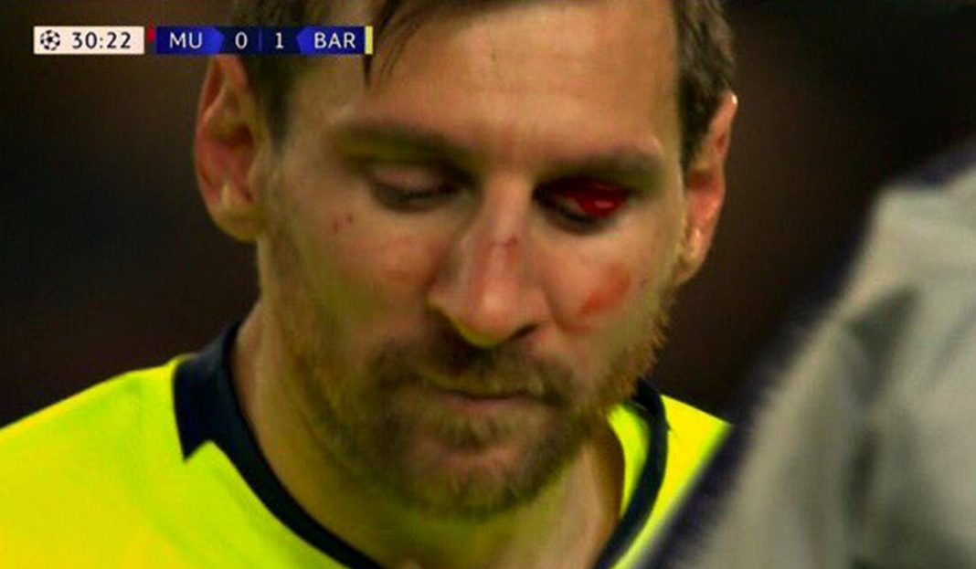 El feroz golpe que recibió Messi de un defensor del Manchester United