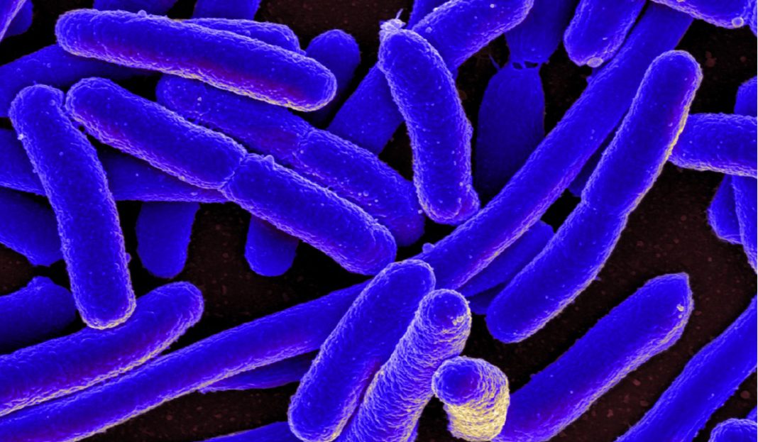 EUA reporta brote bacteriano en cinco estados con 72 infectados