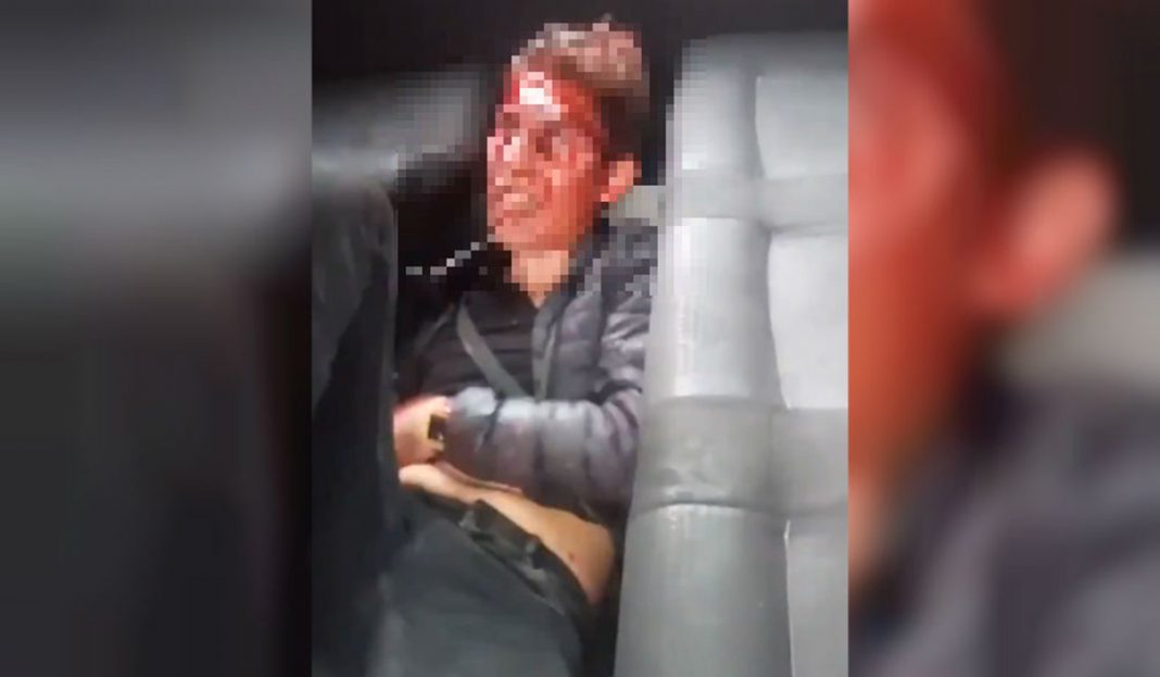 Balean a niño de tres años en asalto a combi; así golpean a asaltante