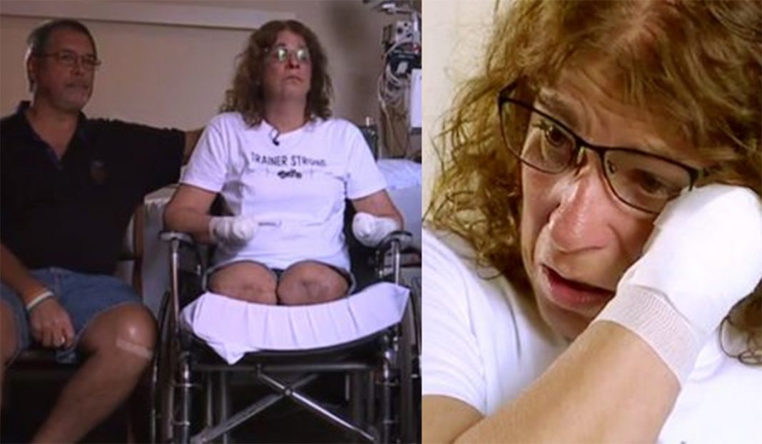 Su perro la lame y le amputan brazos y piernas por infección