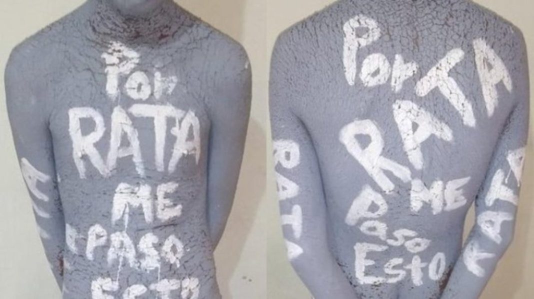 Joven de 15 años es torturado por comando armado y le amputan las dos manos en Veracruz