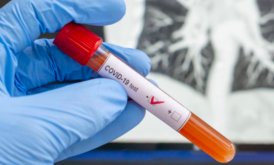 Estos son los casos de coronavirus en México por estados