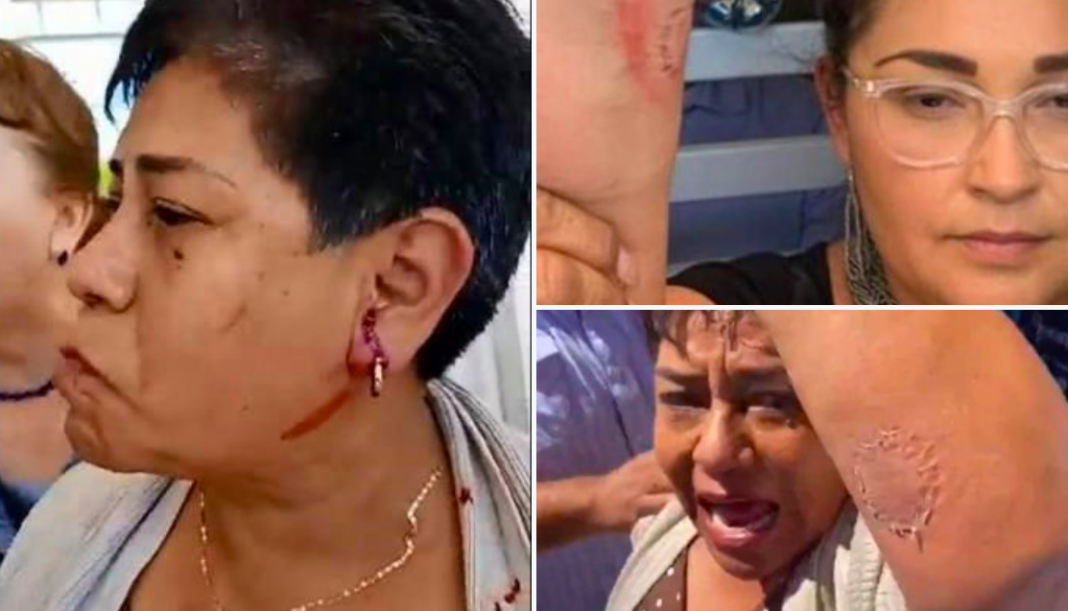 Diputadas riñen a mordidas en BCS