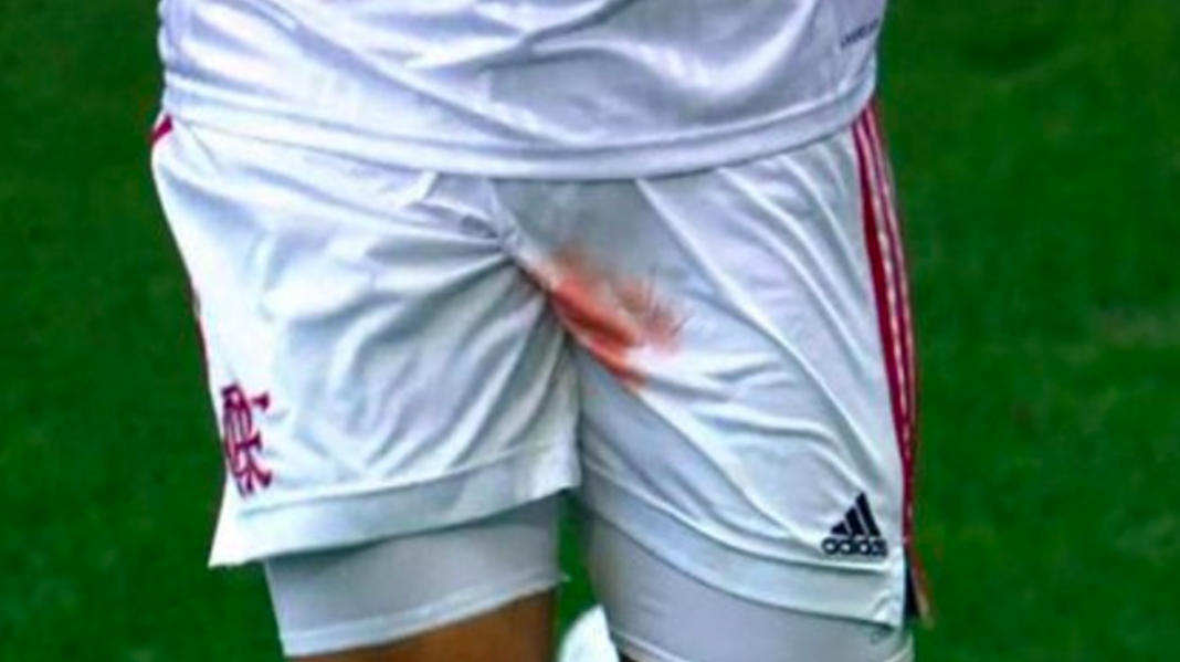 Futbolista sufre lesión en testículo durante partido