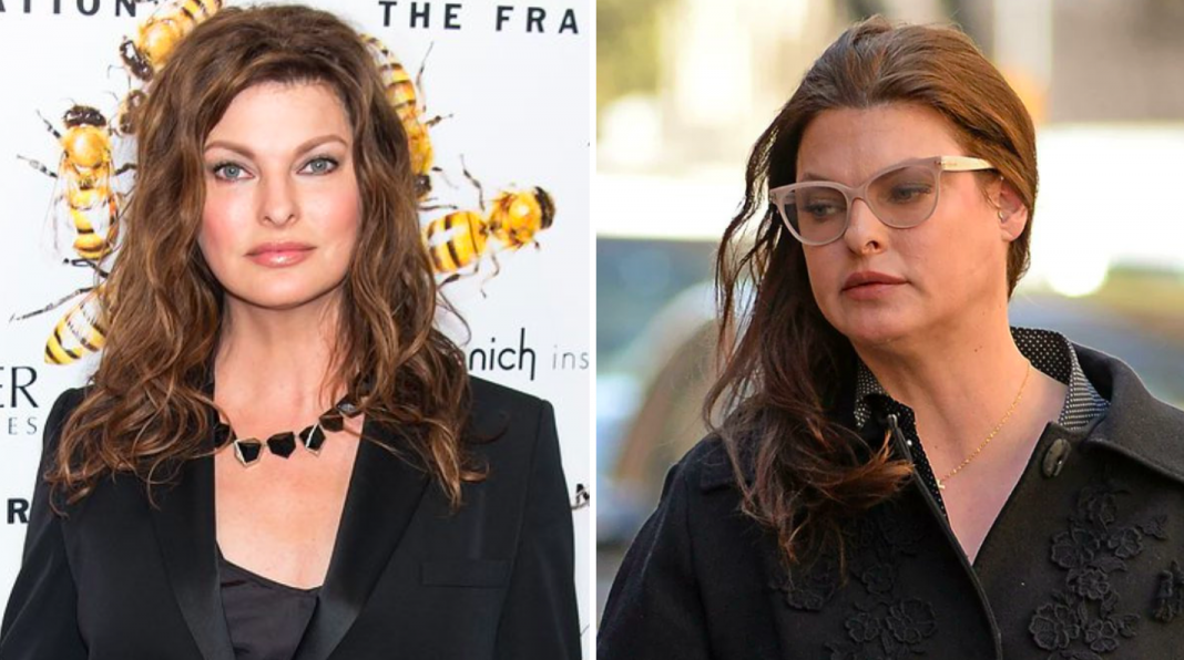 Fui brutalmente desfigurada: Linda Evangelista