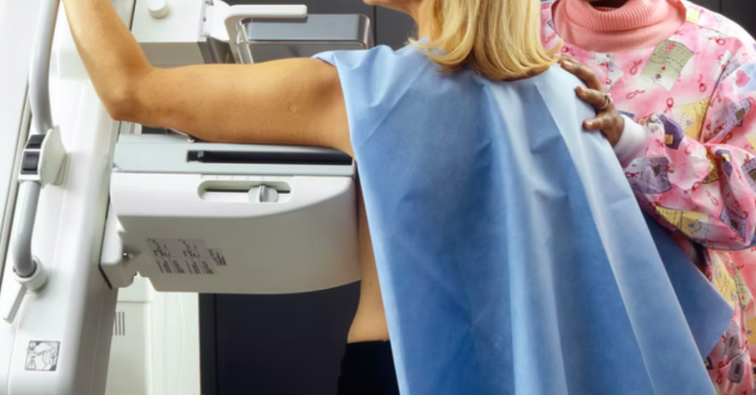 Esto dice el IMSS sobre el cáncer de mama