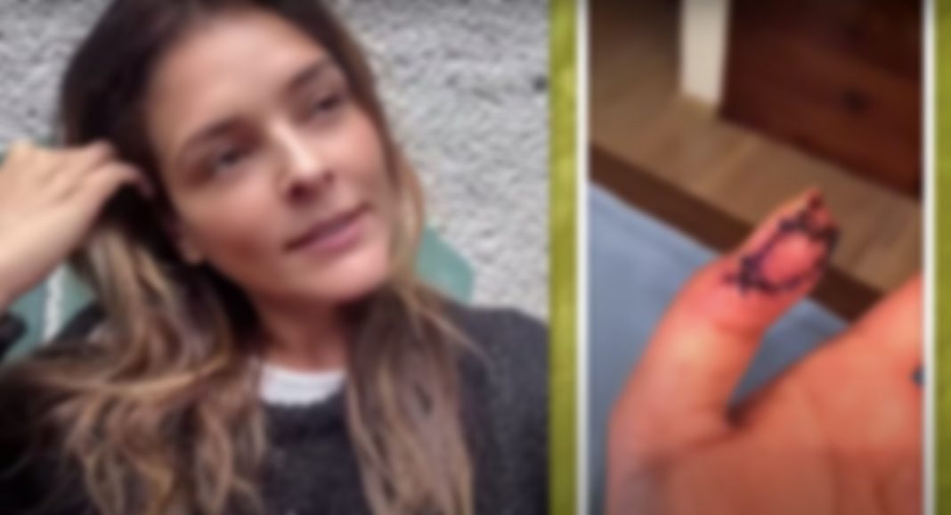 Grettell Valdez recibirá radiación y quimio