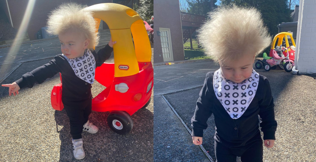 Con 16 meses tiene el ‘síndrome de cabello impeinable’