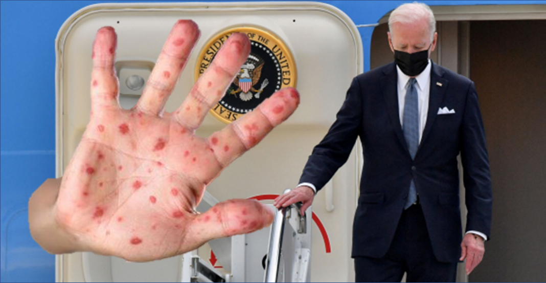 «La viruela del mono debería preocupar a todo el mundo»: Biden