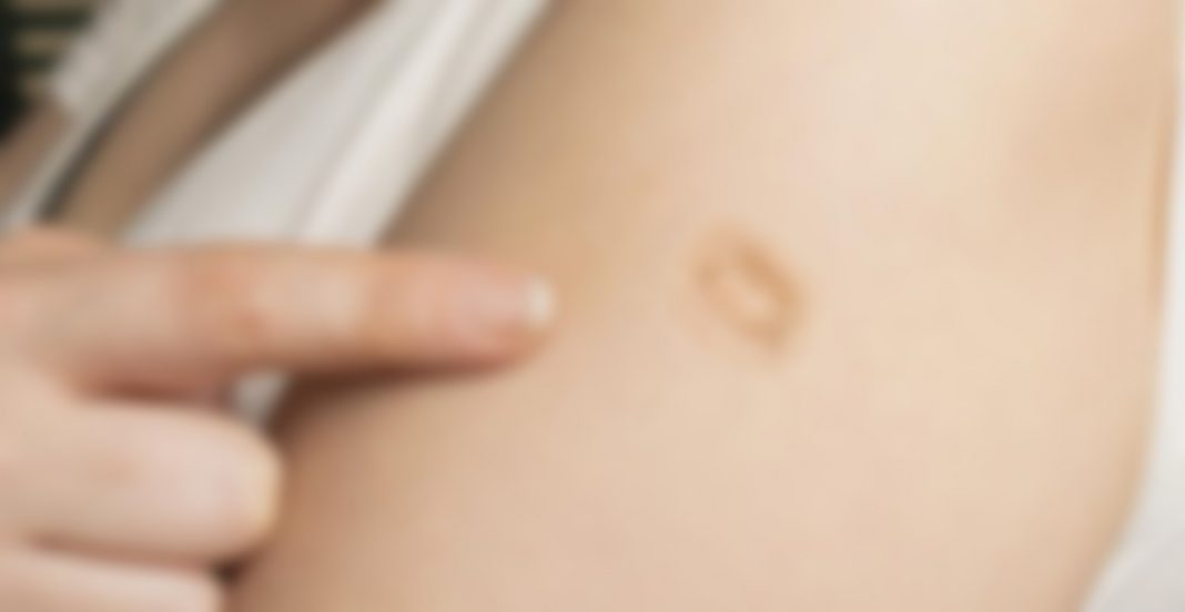 Esta marca te podría hacer inmune a la viruela del mono