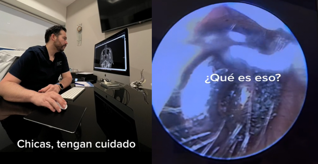 ¿Alguna vez se te ha perdido una pieza de un arete?