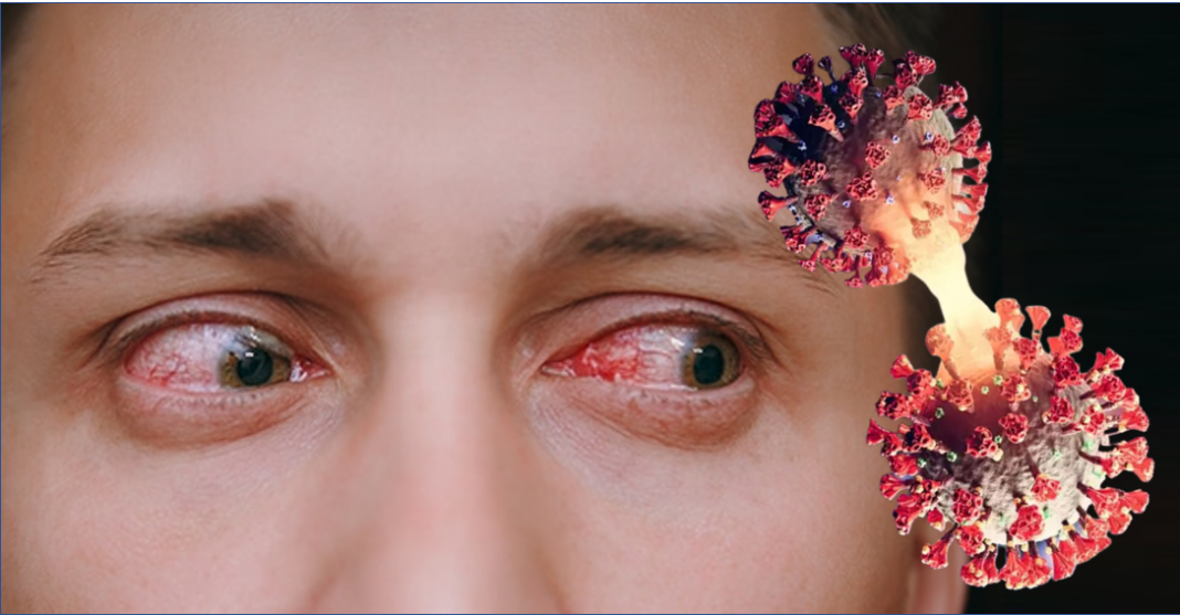 ¿Conjuntivitis? Podría ser ‘Arcturus’ la nueva variante de COVID