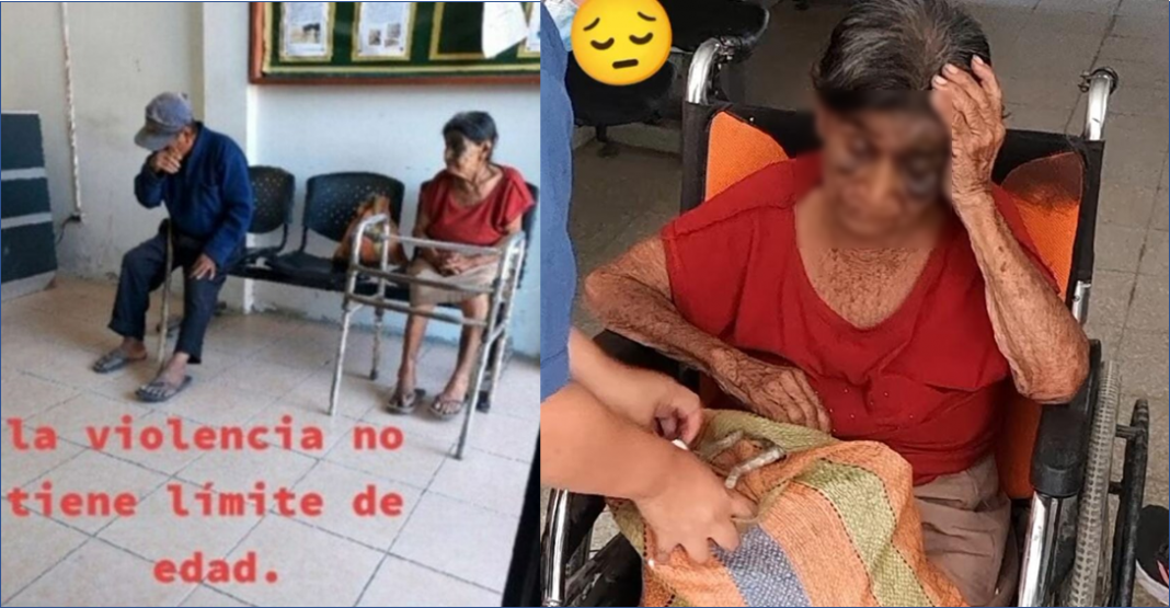 Abuelito golpea a su esposa por poner ‘mucha sal’ a la comida